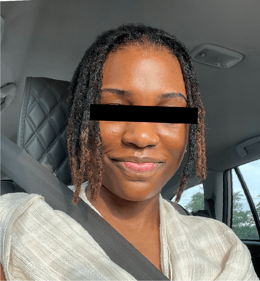 Dorette after treatment