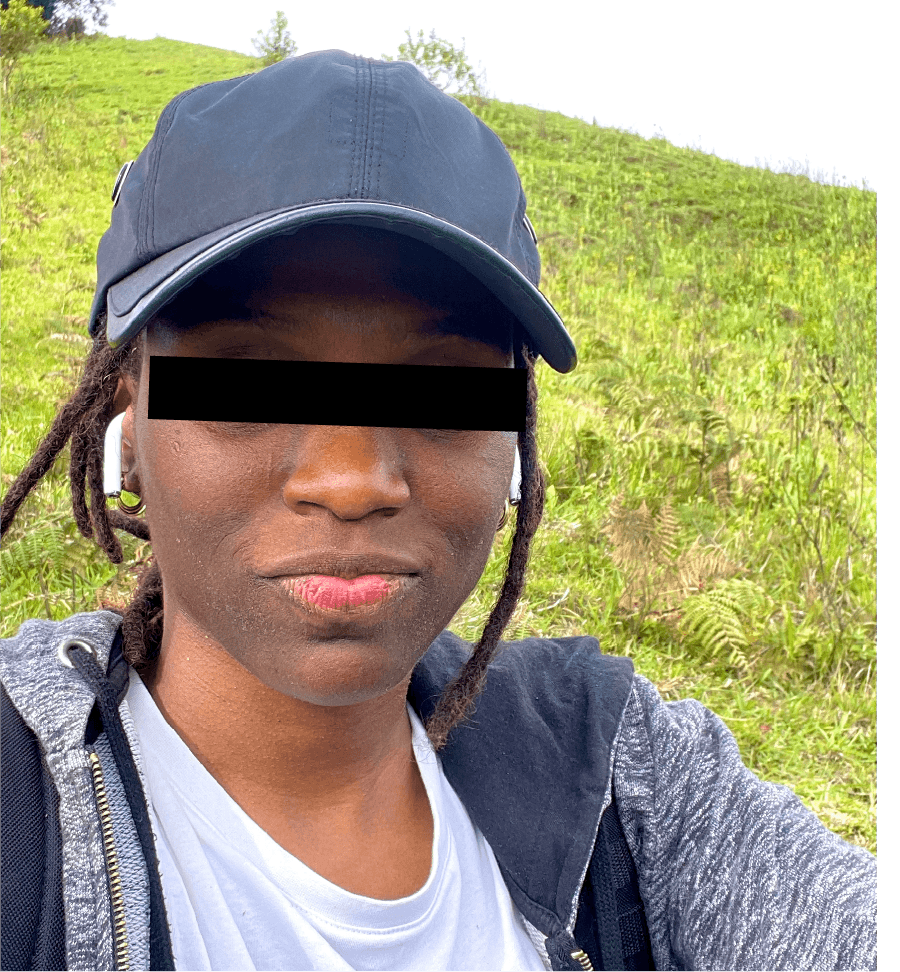 Dorette before treatment